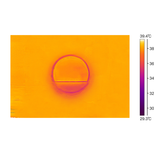 ICSI Fertilization